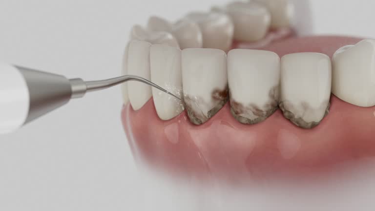 Reliable Dental contractor in Kendale Lakes, FL by Dentist Open Now